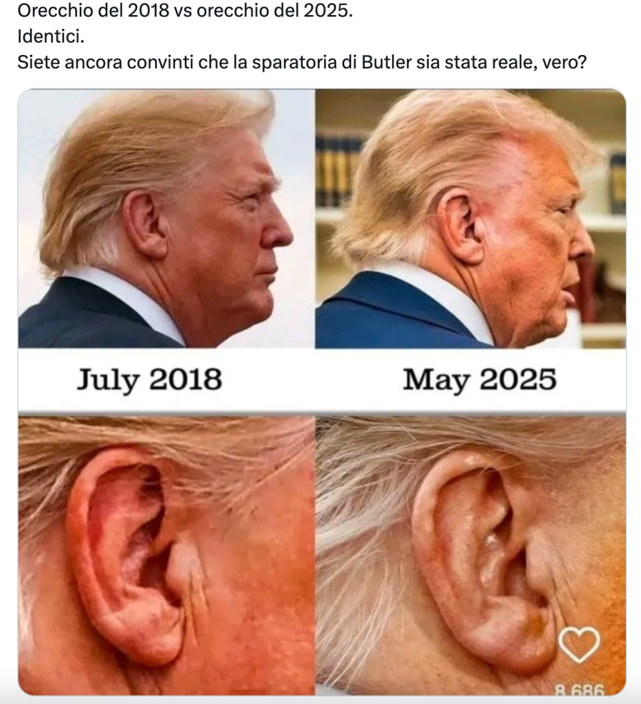 La teoria del complotto sull'orecchio di Trump a un anno dall'attentato
